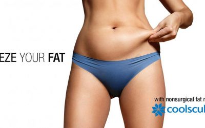 3 Reasons Why You Should Choose Coolsculpting