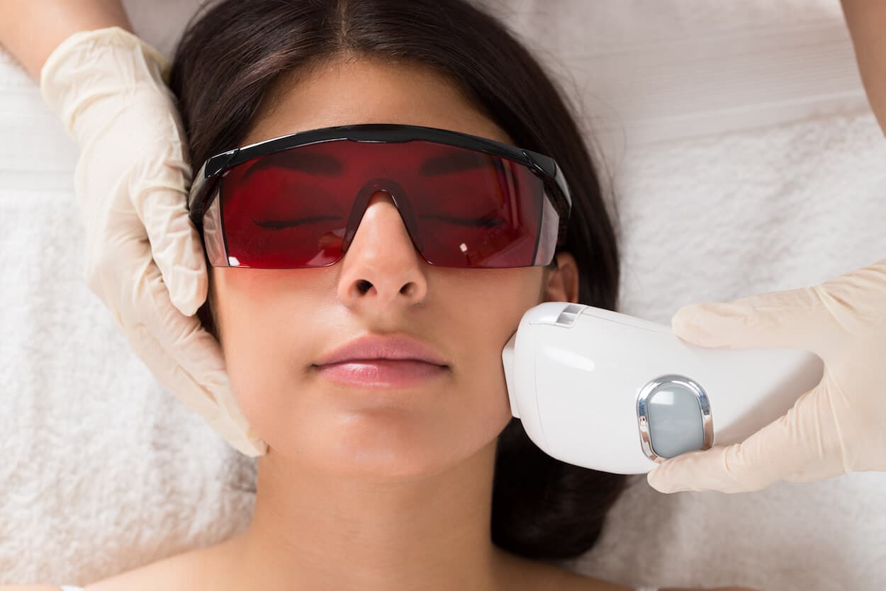 ipl photofacial in boca raton, florida - nuways md